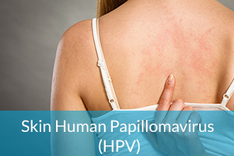 Skin Human Papillomavirus (HPV)